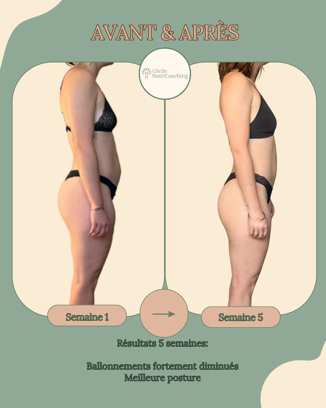 avant-apres-nutrition-ballonements-posture-amelioree